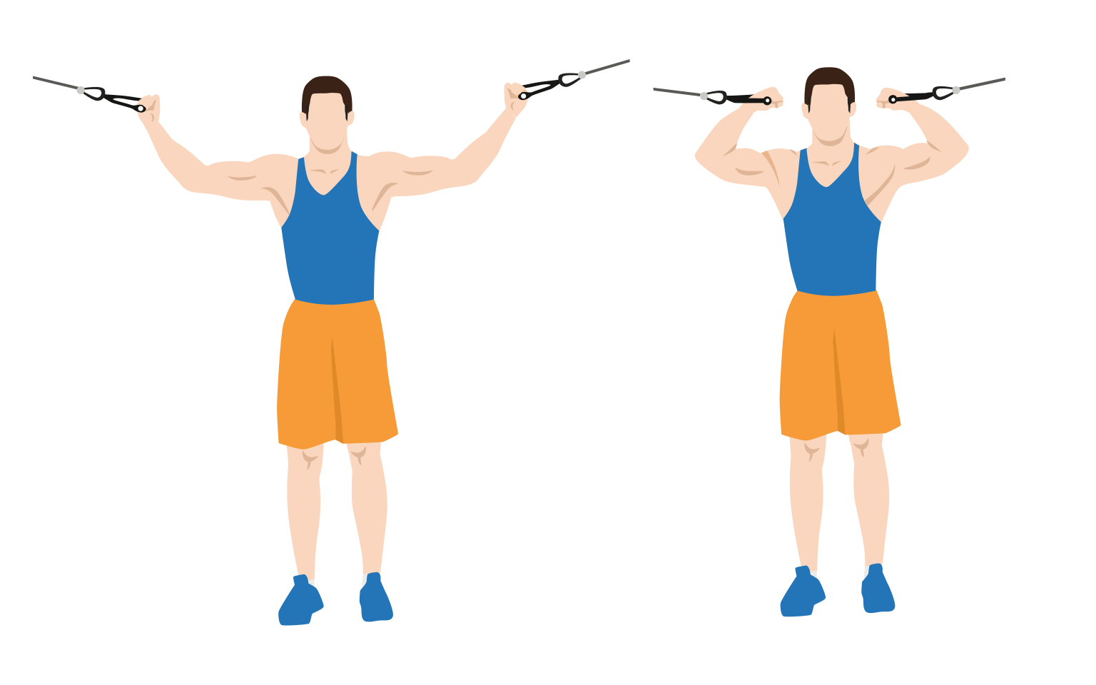 illustration - Overhead cable curls