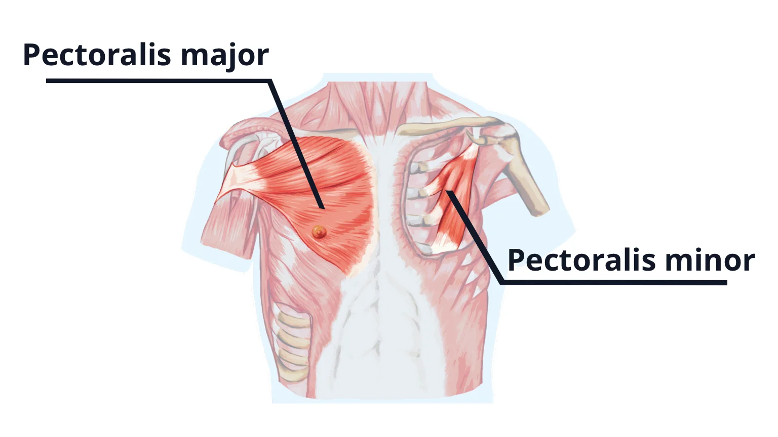Diagram showing location of pecs major and pecs minor. The pecs are a muscle targeted on your push day.