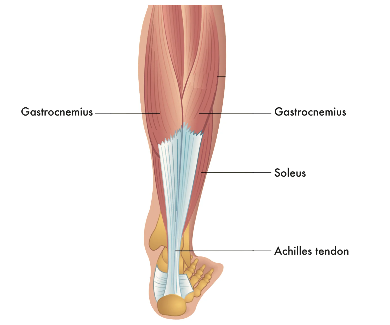 diagram - View of the back of the lower leg, showing the position of the calf muscle. The diagram shows how the gastrocnemius and soleus muscles connect to the Archilles tendon.