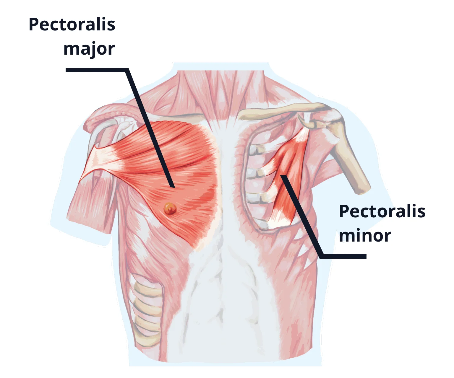 diagram - Showing the anatomy of the chest area. The pectoralis major and pectoralis minor are labelled.